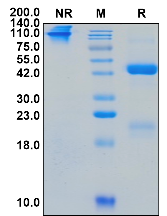 Recombinant Human FSH alpha & FSH beta Protein (hFc Tag)